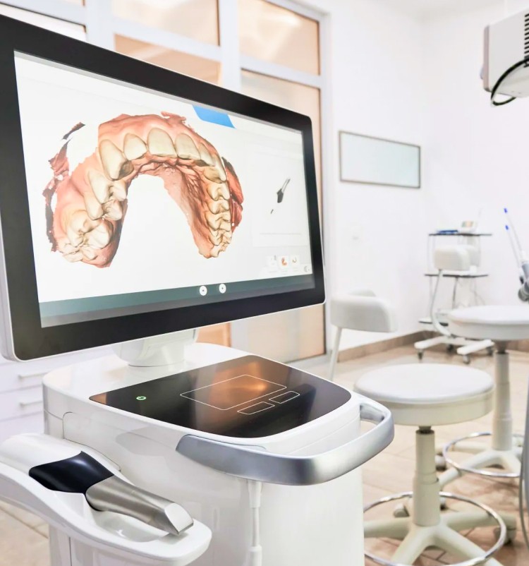 Appareil pour la prise d'empreinte optique numérique au cabinet Implantocean