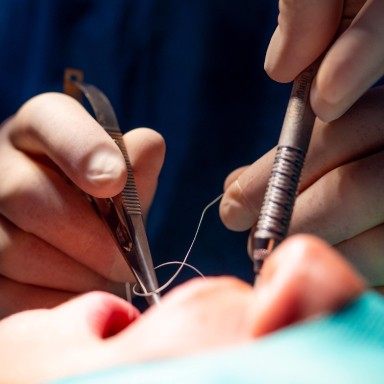 Mise en place d'un implant dentaire au cabinet Implantocean à La Baule