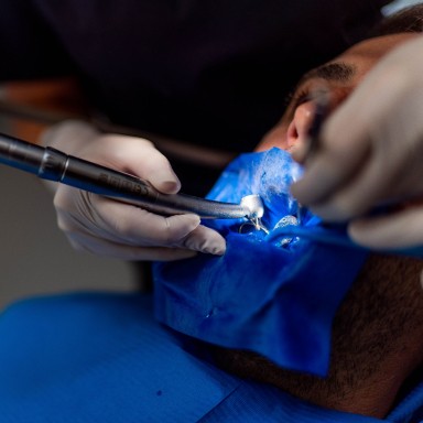 Opération des dents de sagesse au cabinet dentaire Implantocean à La Baule