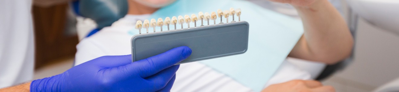 Choix des facettes dentaires au cabinet dentaire Implantocean à La Baule